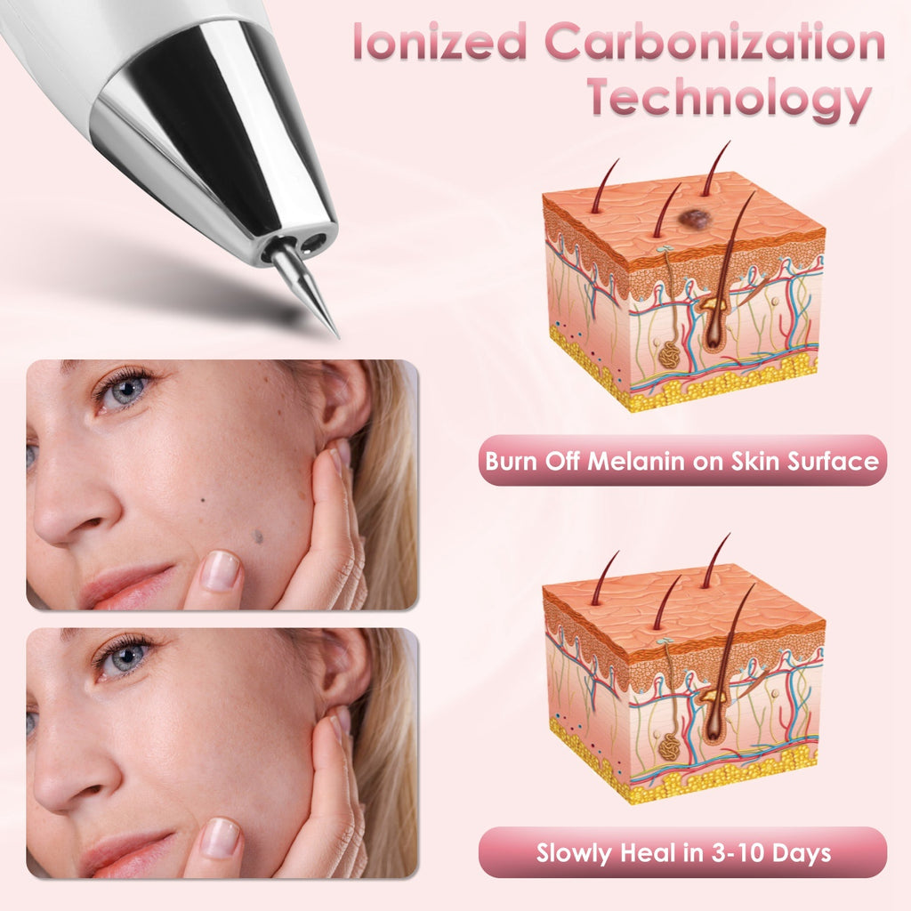 Skin Tag Remover Pen - Electric Spot Mole Wart Removal Tool with 9 Levels