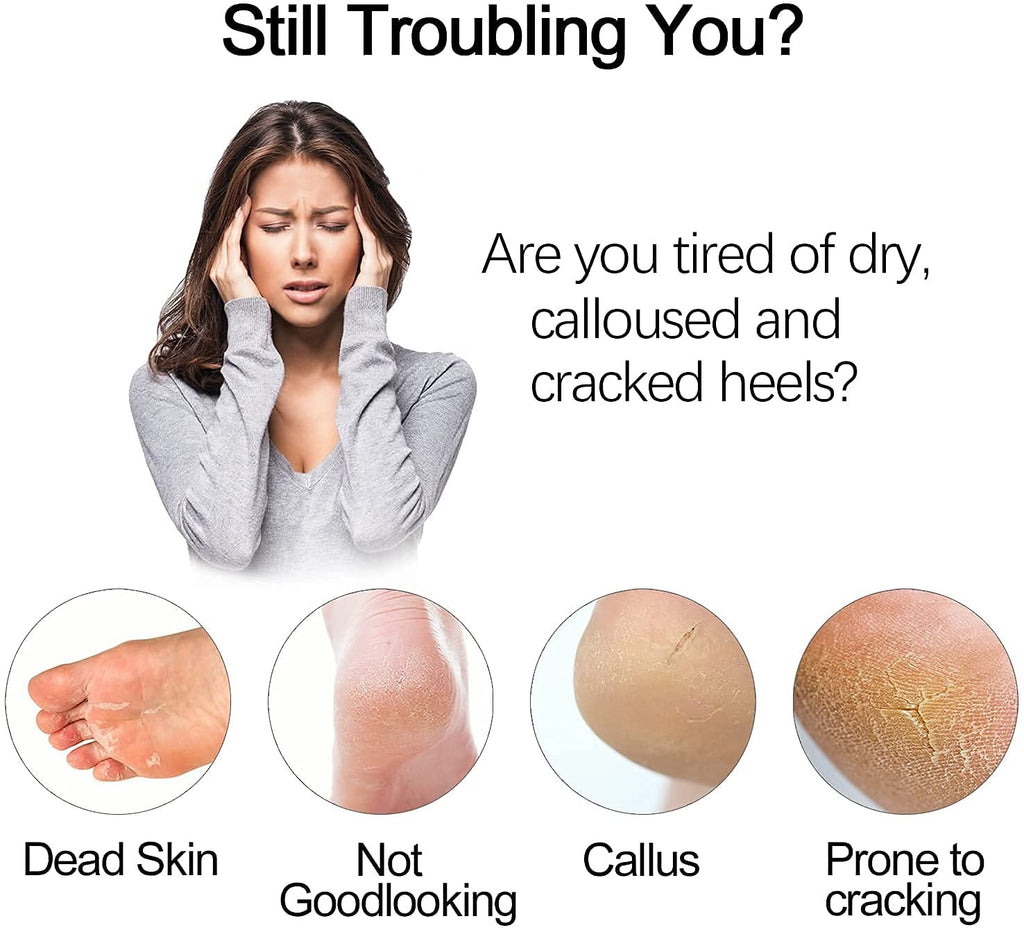 Electric Foot Callus Remover with Vacuum - Mess-Free Pedicure Tool