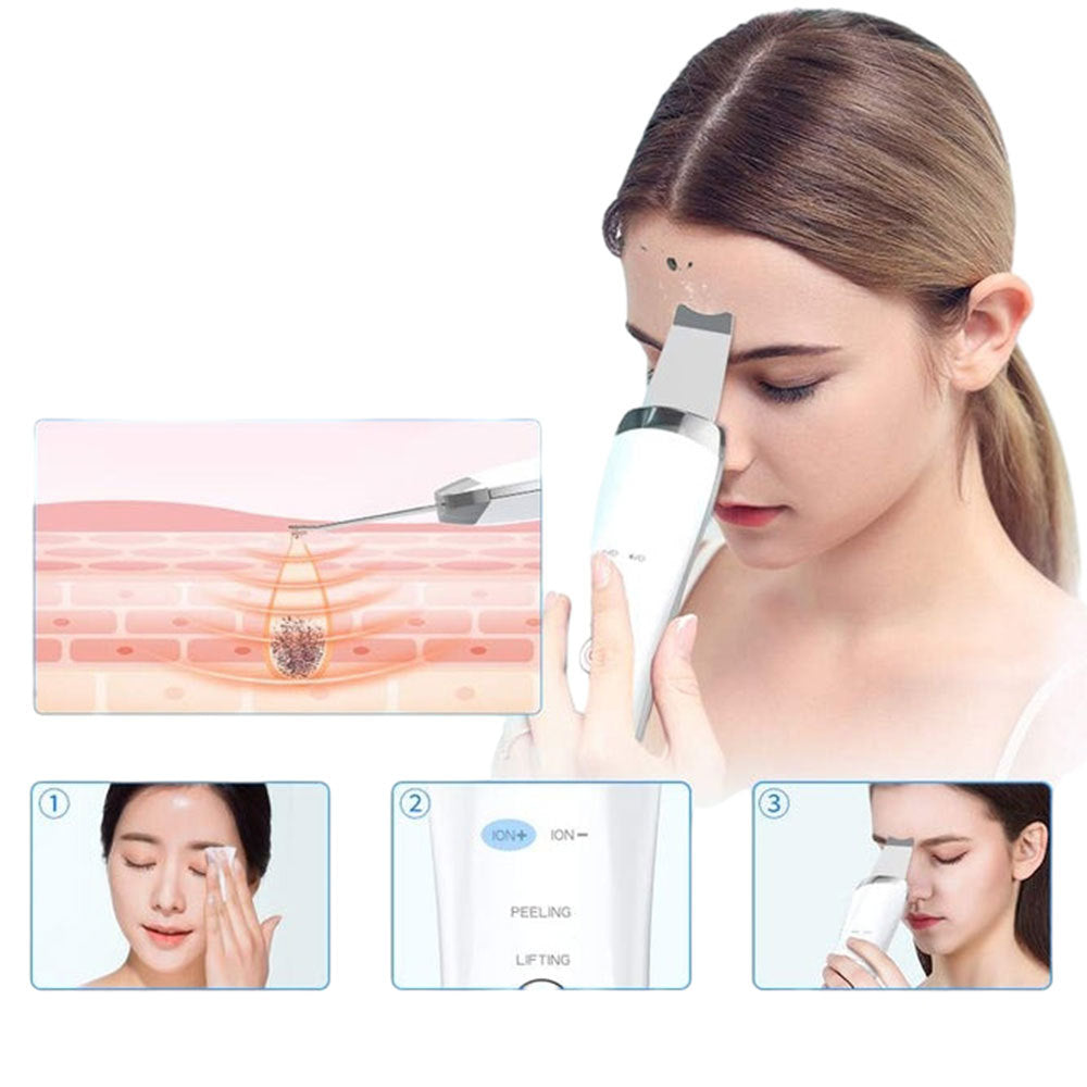Ultrasonic Skin Scrubber - Electric Facial Spatula for Deep Pore Cleansing